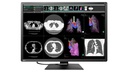 EIZO RadiForce RX1270 computer monitor 78.7 cm (31") 4200 x 2800 pixels LCD Black, White