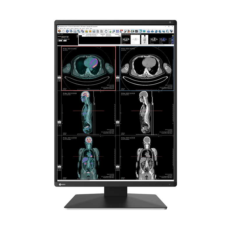 EIZO RadiForce RX370 computer monitor 54.1 cm (21.3") 1536 x 2048 pixels LCD Black