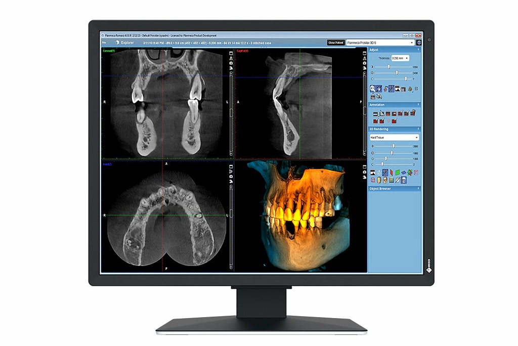 EIZO RadiForce MX217-SB computer monitor 53.3 cm (21") 1200 x 1600 pixels UXGA LCD Black