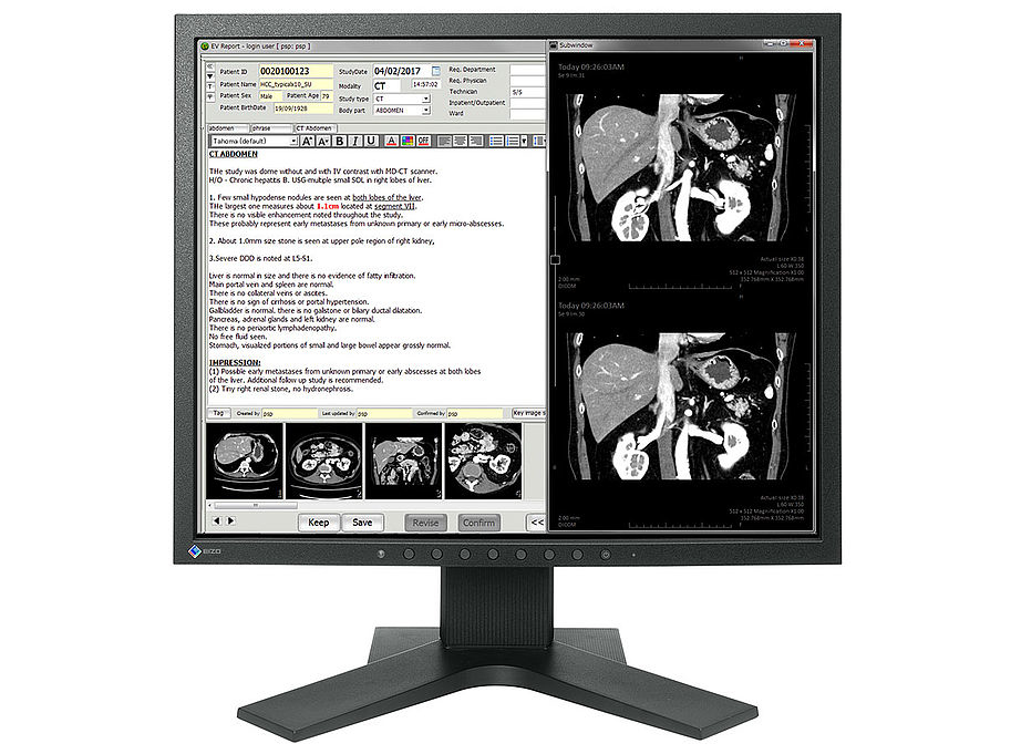 EIZO RadiForce MX194 computer monitor 48.3 cm (19") 1280 x 1024 pixels LCD Black